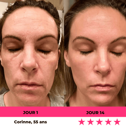MaskPeelOffCollagen - Revea