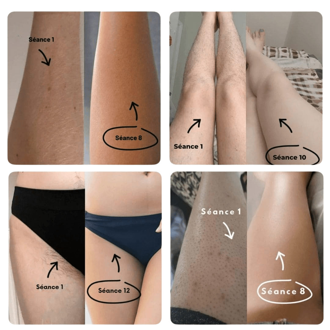 #MaskPeelOffCollagen# - #Revea#