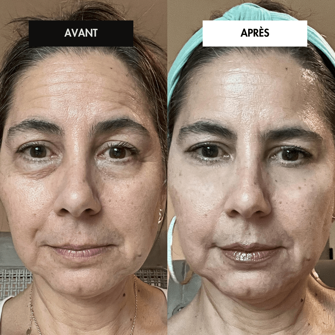 #MaskPeelOffCollagen# - #Revea#