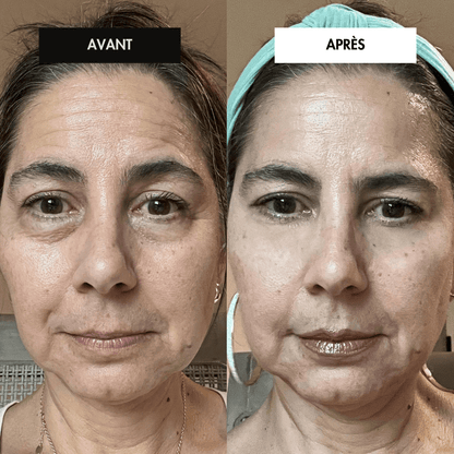 #MaskPeelOffCollagen# - #Revea#