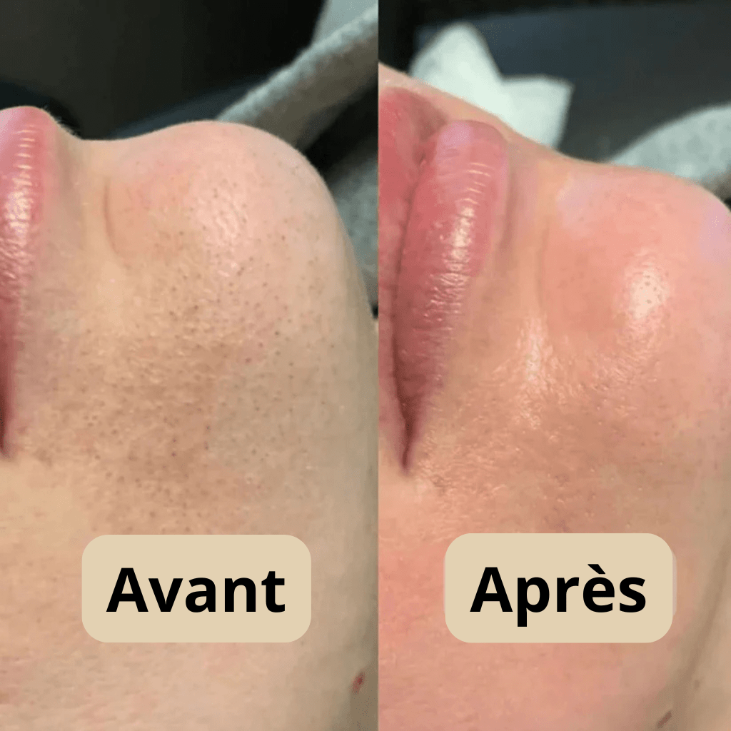 MaskPeelOffCollagen - Revea