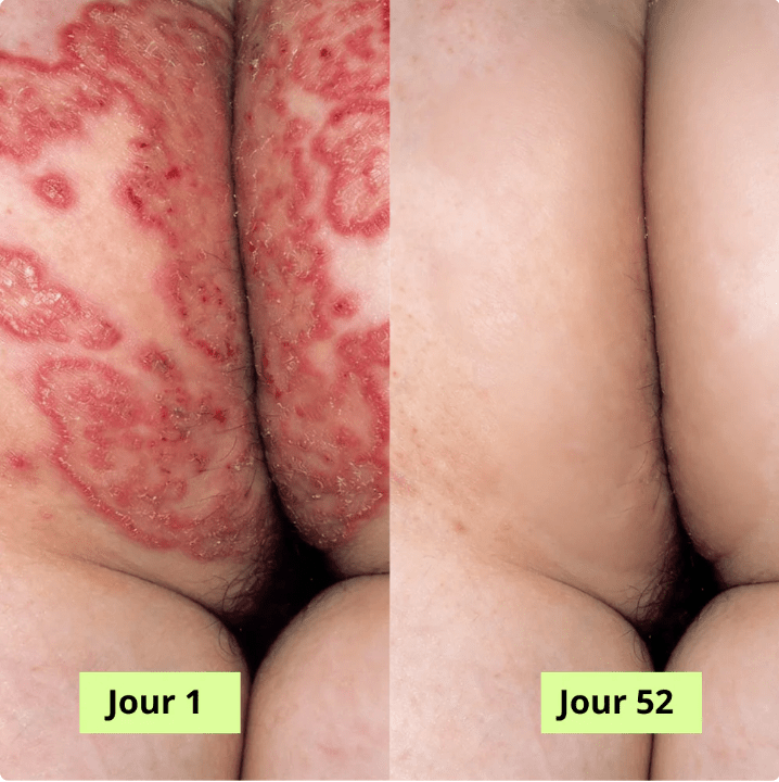 MaskPeelOffCollagen - Revea
