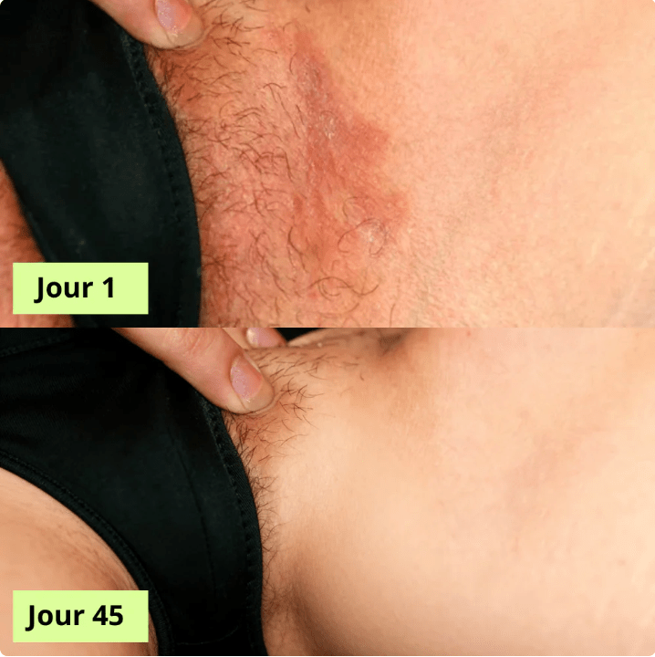 MaskPeelOffCollagen - Revea