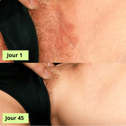 MaskPeelOffCollagen - Revea