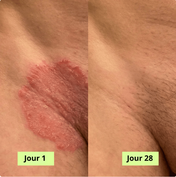 MaskPeelOffCollagen - Revea