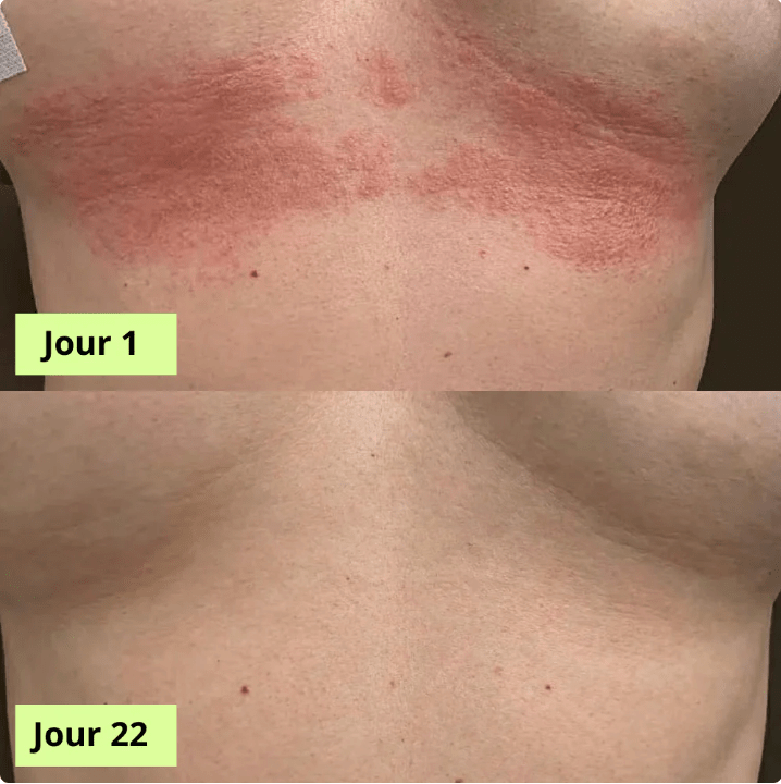 MaskPeelOffCollagen - Revea