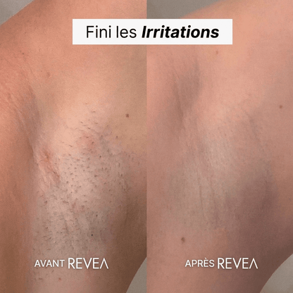 MaskPeelOffCollagen - Revea