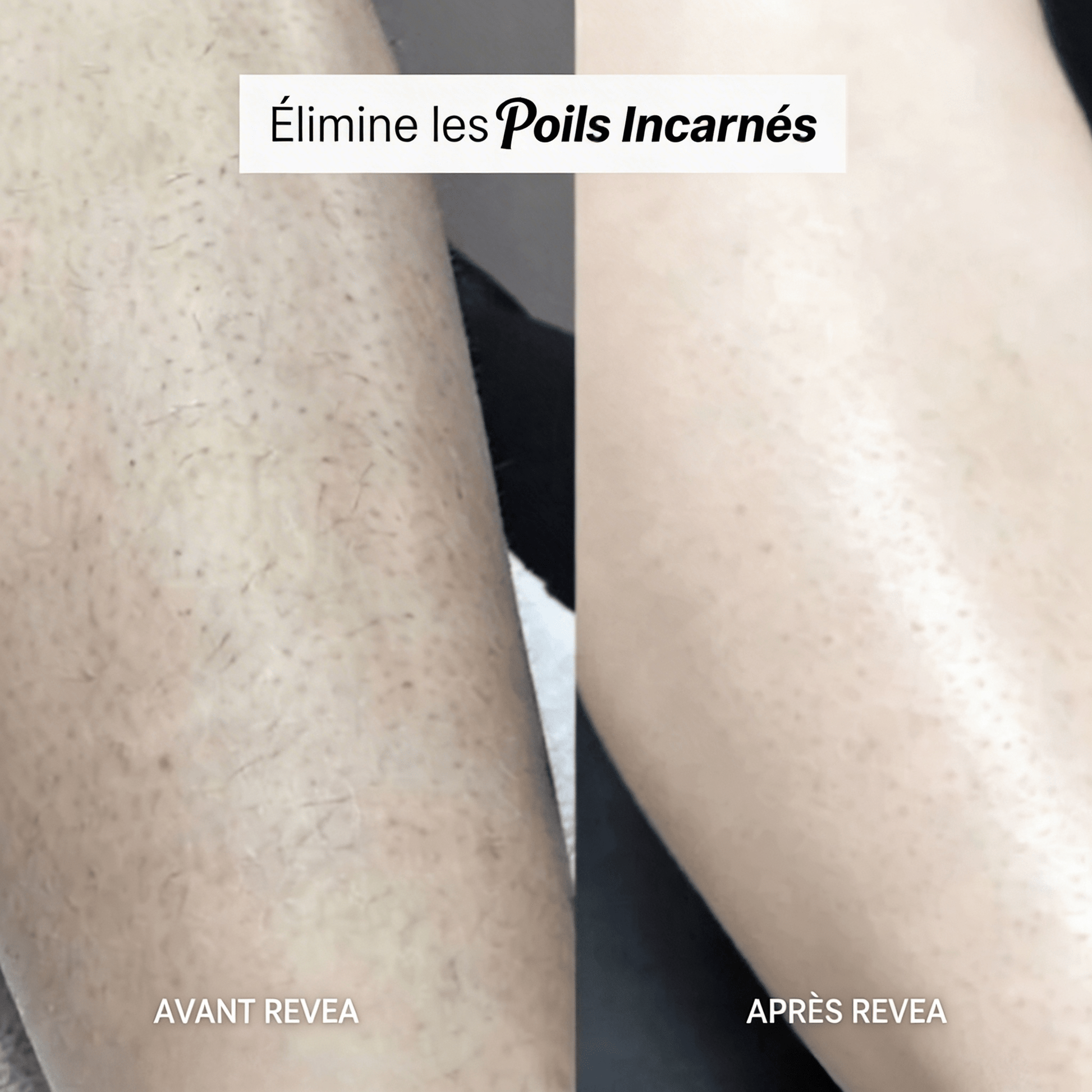 MaskPeelOffCollagen - Revea