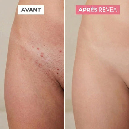 MaskPeelOffCollagen - Revea